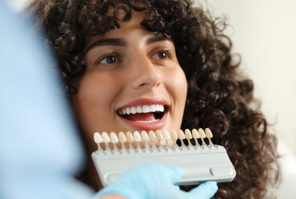 veneers los angeles